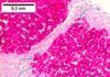 Hallan un ‘escudo natural’ frente a la infección del virus C de la hepatitis Hallan un ‘escudo natural’ frente a la infección del virus C de la hepatitis