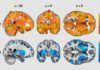 El cerebro alerta del riesgo de obesidad El cerebro alerta del riesgo de obesidad