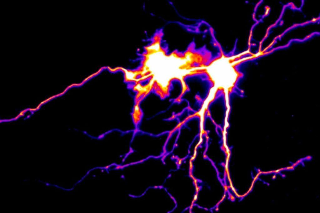 Las personas con autismo tienen menos neuronas y axones