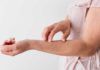Tres proteínas originan inflamación en psoriasis Tres proteínas originan inflamación en psoriasis