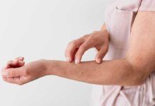 Tres proteínas originan inflamación en psoriasis Tres proteínas originan inflamación en psoriasis