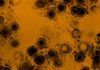 Descubren la estrategia del virus del herpes para infectar el sistema nervioso Descubren la estrategia del virus del herpes para infectar el sistema nervioso