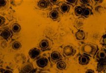 Descubren la estrategia del virus del herpes para infectar el sistema nervioso Descubren la estrategia del virus del herpes para infectar el sistema nervioso