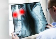 ¿Por qué unos casos de Covid-19 son más graves que otros? ¿Por qué unos casos de Covid-19 son más graves que otros?