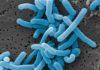 ‘Lactobacillus’ del intestino pueden debilitar la inmunidad en cáncer de páncreas ‘Lactobacillus’ del intestino pueden debilitar la inmunidad en cáncer de páncreas