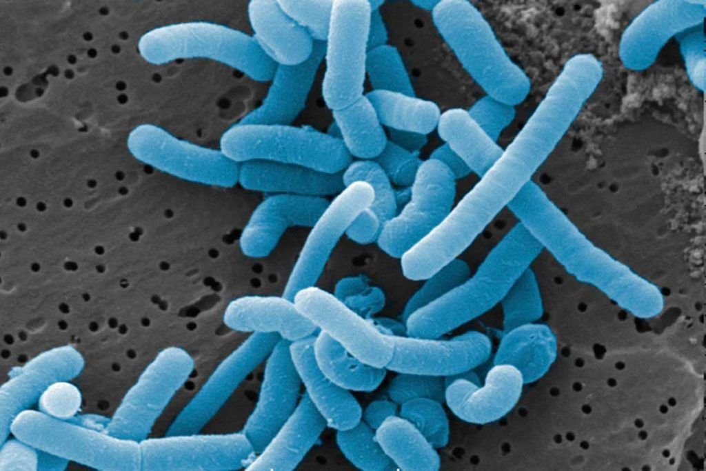 ‘Lactobacillus’ del intestino pueden debilitar la inmunidad en cáncer de páncreas