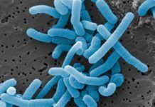 ‘Lactobacillus’ del intestino pueden debilitar la inmunidad en cáncer de páncreas ‘Lactobacillus’ del intestino pueden debilitar la inmunidad en cáncer de páncreas