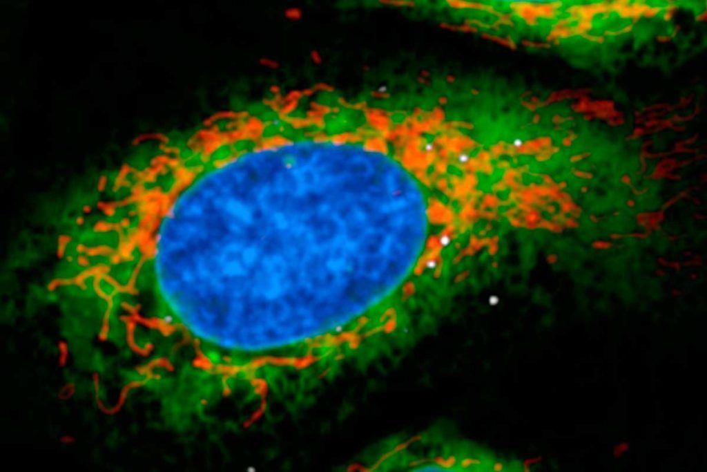 Cómo la bacteria ‘legionella’ engaña al sistema inmune