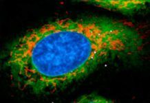 Cómo la bacteria ‘legionella’ engaña al sistema inmune Cómo la bacteria ‘legionella’ engaña al sistema inmune