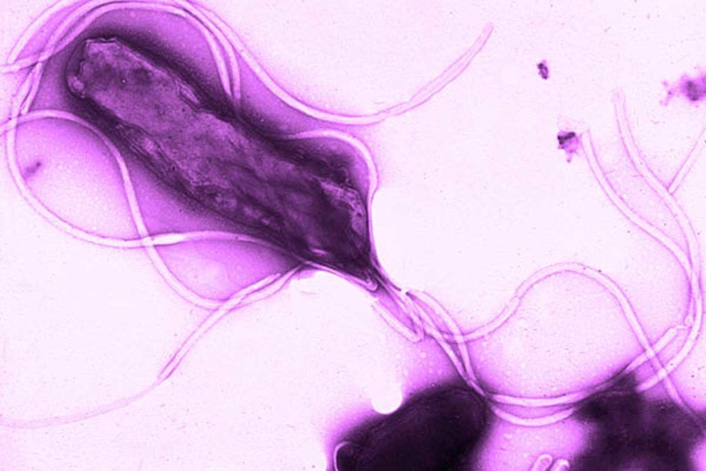 ‘Trampas ópticas’ contra Helicobacter pylori