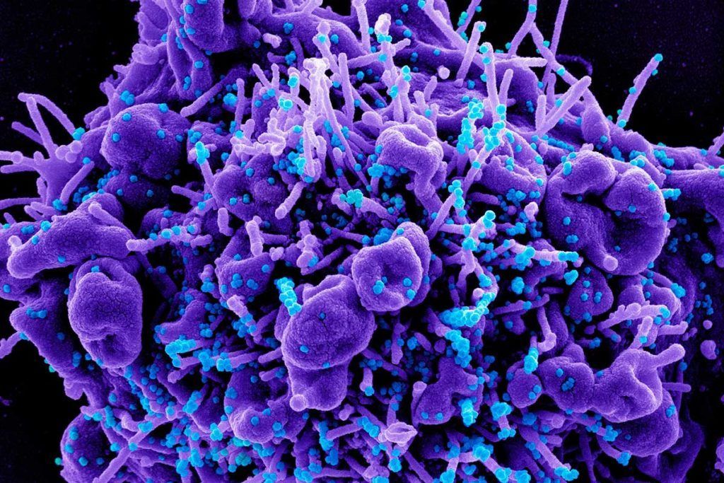 A propósito de los linfocitos T, diana celular del nuevo coronavirus