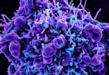 A propósito de los linfocitos T, diana celular del nuevo coronavirus A propósito de los linfocitos T, diana celular del nuevo coronavirus