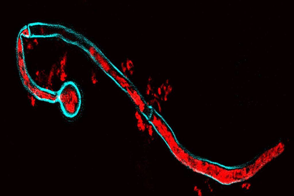 Visualizan el ‘secuestro’ del sistema inmune
