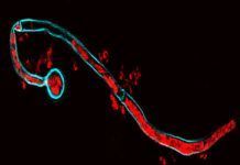 Visualizan el ‘secuestro’ del sistema inmune Visualizan el ‘secuestro’ del sistema inmune