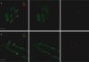 Biopsia de piel para identificar Parkinson Biopsia de piel para identificar Parkinson