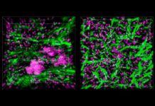 Reproducen el sistema inmunitario en un ‘chip’ Reproducen el sistema inmune en un chip