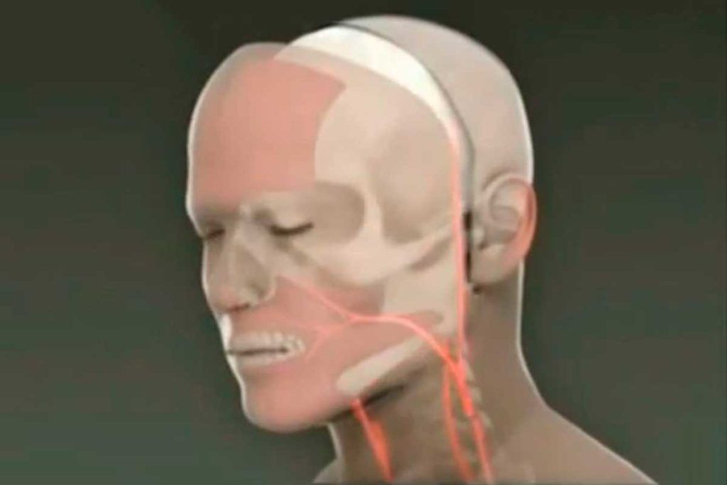 Avances en técnicas de trasplante facial