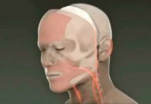 Avances en técnicas de trasplante facial Avances en técnicas de trasplante facial