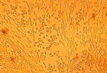 Vinculan al virus del herpes con trastornos neurodegenerativos Vinculan al virus del herpes con trastornos neurodegenerativos