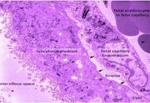 Papel activo de la placenta con la vitamina D y el feto Papel activo de la placenta con la vitamina D y el feto