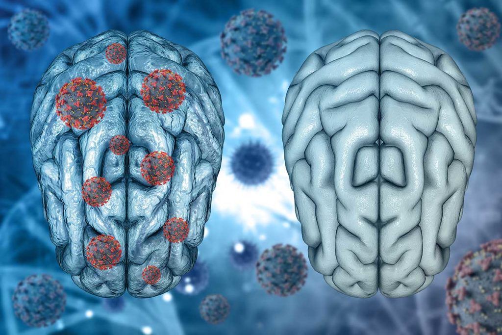 Covid persistente: el deterioro cognitivo grave equivale a 20 años de envejecimiento