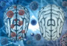 Covid persistente: el deterioro cognitivo grave equivale a 20 años de envejecimiento Covid persistente: el deterioro cognitivo grave equivale a 20 años de envejecimiento