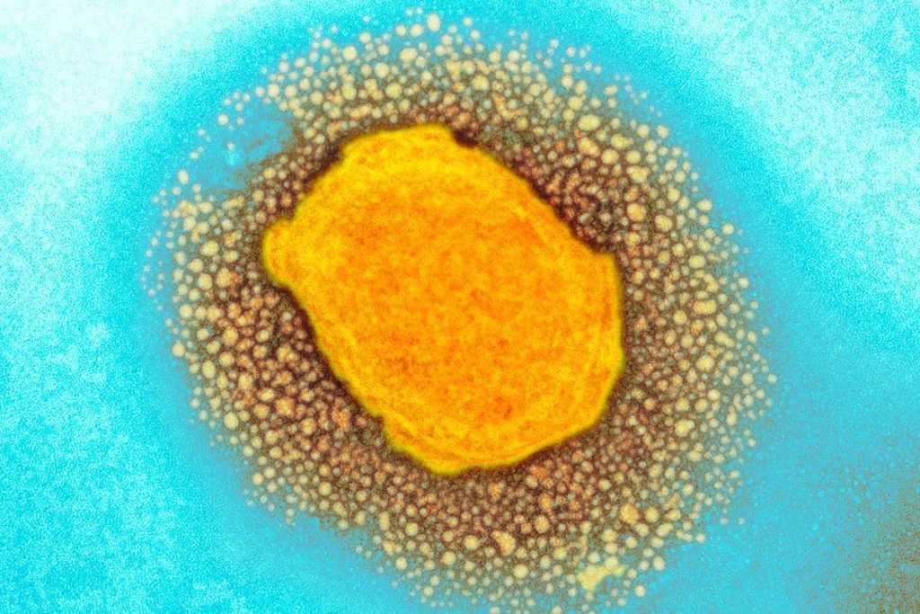Alerta mundial por el virus de la viruela
