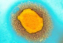 Alerta mundial por el virus de la viruela Alerta mundial por el virus de la viruela
