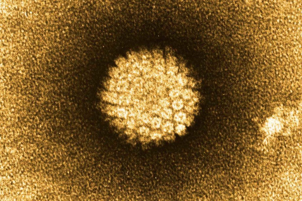 Cáncer de cabeza y cuello y virus del papiloma humano