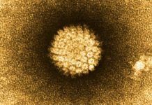 Cáncer de cabeza y cuello y virus del papiloma humano Cáncer de cabeza y cuello y virus del papiloma humano