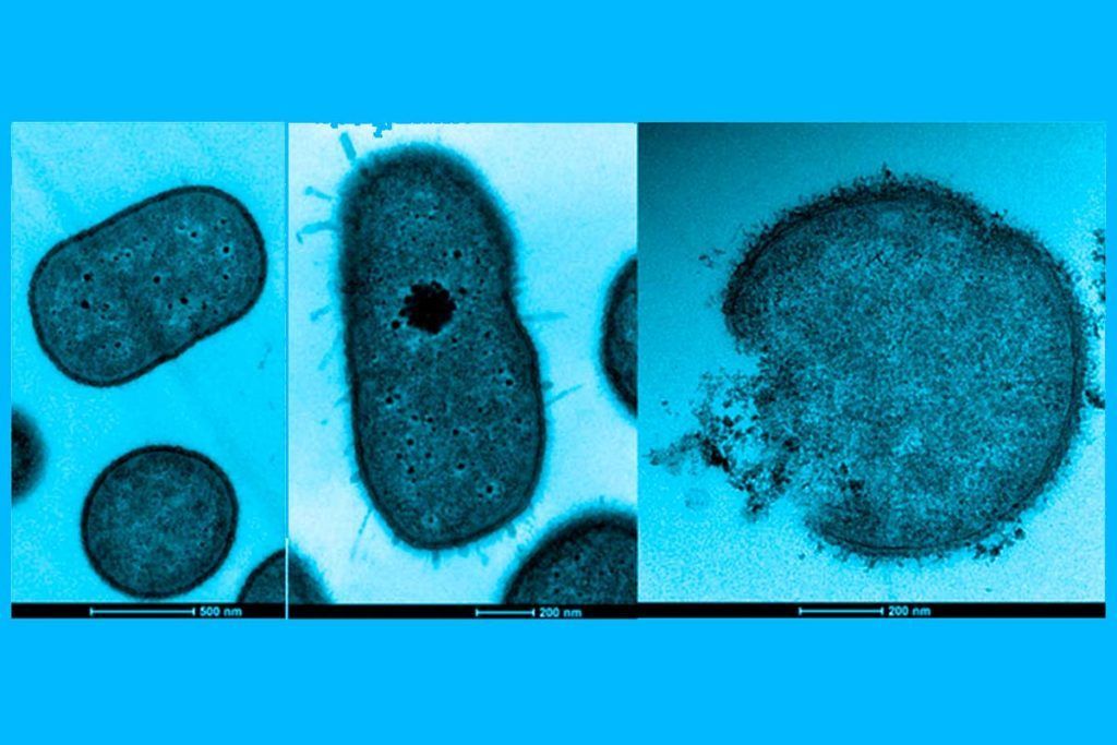 Visualizan cómo bacterias hospitalarias resisten a los antibióticos