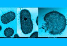 Visualizan cómo bacterias hospitalarias resisten a los antibióticos Visualizan cómo bacterias hospitalarias resisten a los antibióticos