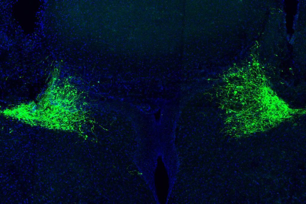 ¿Cómo responde el cerebro ante situaciones sorprendentes?