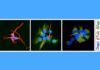 Astrocitos: clave frente al glioblastoma Astrocitos: clave frente al glioblastoma