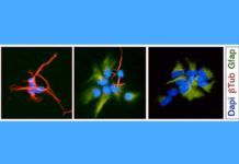 Astrocitos: clave frente al glioblastoma Astrocitos: clave frente al glioblastoma