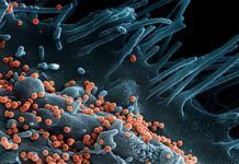 Descubren cómo detener la infección por el virus Lassa Descubren cómo detener la infección por el virus Lassa