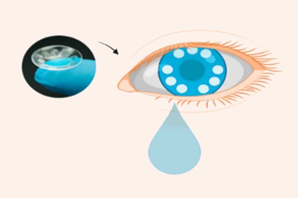 Lentillas que diagnostican cáncer