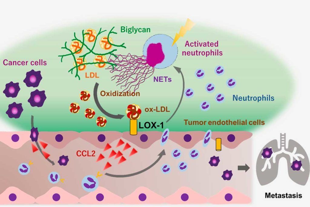 La aterosclerosis y la progresión del cáncer comparten mecanismos moleculares