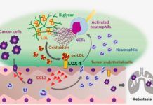 La aterosclerosis y la progresión del cáncer comparten mecanismos moleculares La aterosclerosis y la progresión del cáncer comparten mecanismos moleculares