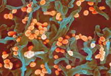 Preocupación por la expansión del virus Lassa Preocupación por la expansión del virus Lassa