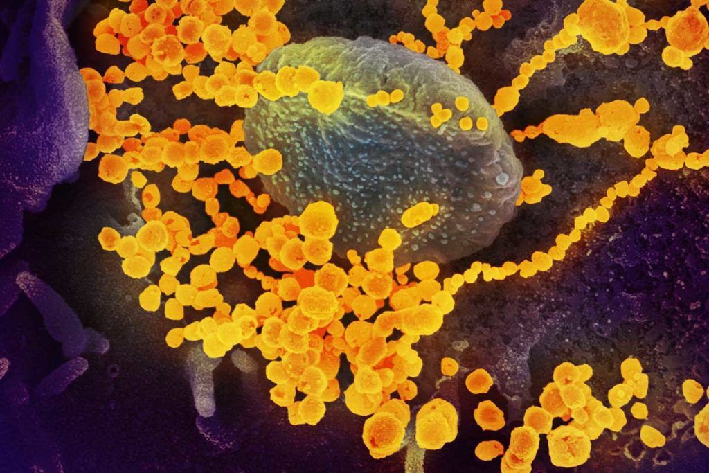 Revelan cómo se comunica el SARS-CoV-2 con las células a las que infecta