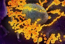 Revelan cómo se comunica el SARS-CoV-2 con las células a las que infecta Revelan cómo se comunica el SARS-CoV-2 con las células a las que infecta