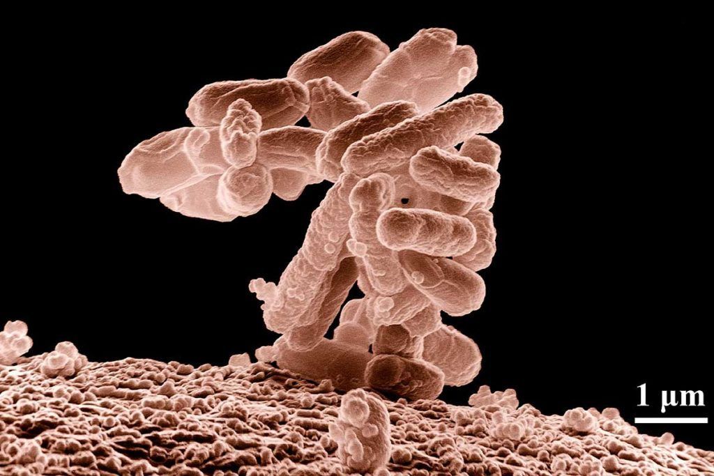 Cómo la bacteria E. coli evita los antibióticos
