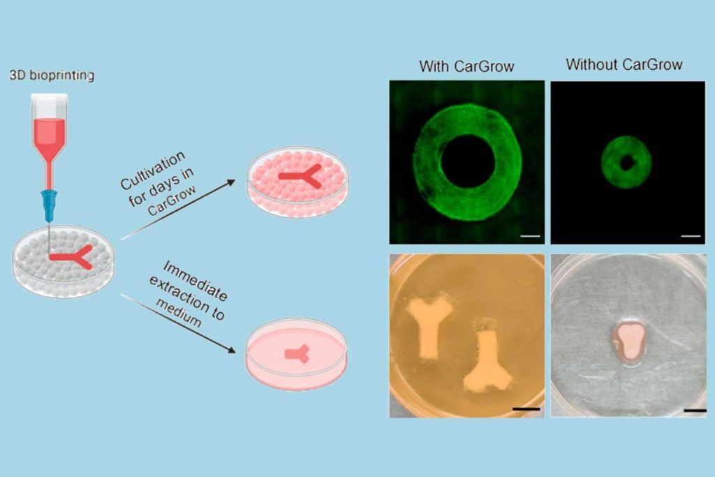 Paso de gigante en la bioimpresión para trasplantes