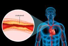 Cuestionan el colesterol ‘bueno’ para prevenir la enfermedad cardíaca Cuestionan el colesterol ‘bueno’ para prevenir la enfermedad cardíaca