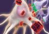 El Nobel Prusiner afirma que síndrome de Down y Alzheimer son trastornos de doble prión El Nobel Prusiner afirma que síndrome de Down y Alzheimer son trastornos de doble prión
