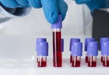 El cáncer de páncreas se puede diagnosticar tres años antes de que aparezca El cáncer de páncreas se puede diagnosticar tres años antes de que aparezca