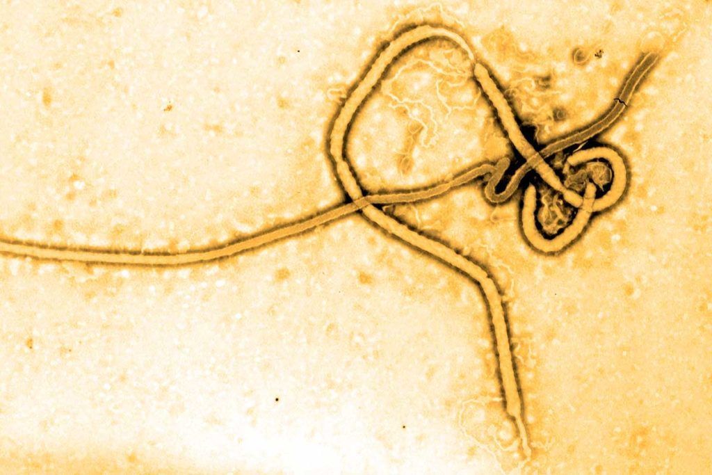 Anticuerpos humanos contra dos variedades del Ébola