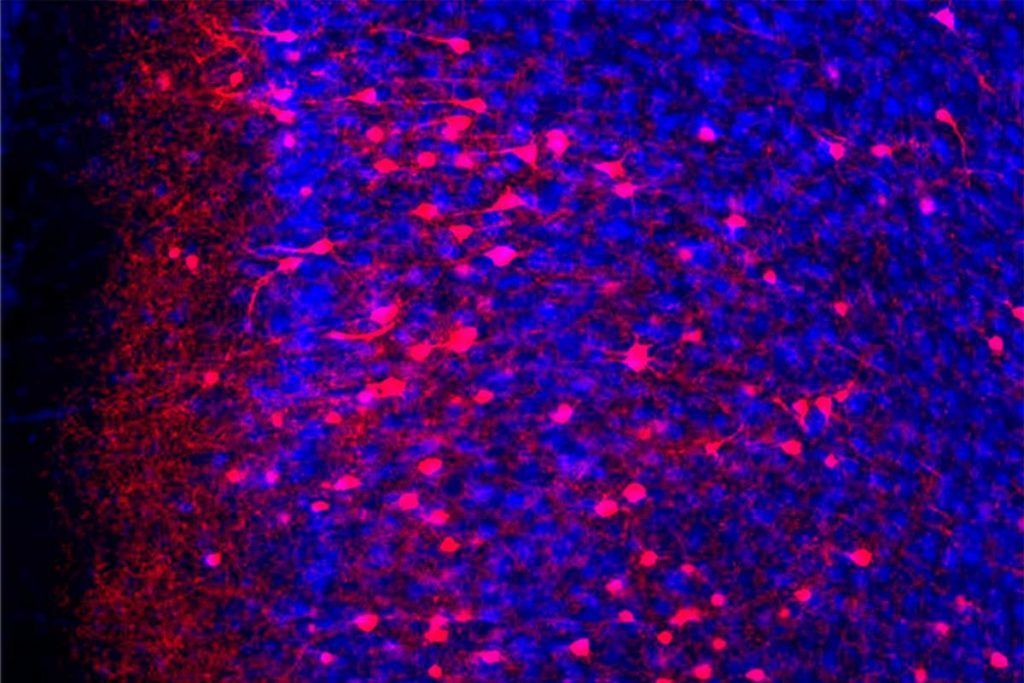 Visualizan el miedo remoto en el cerebro