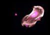 Avances en el sarcoma de Ewing Avances en el sarcoma de Ewing